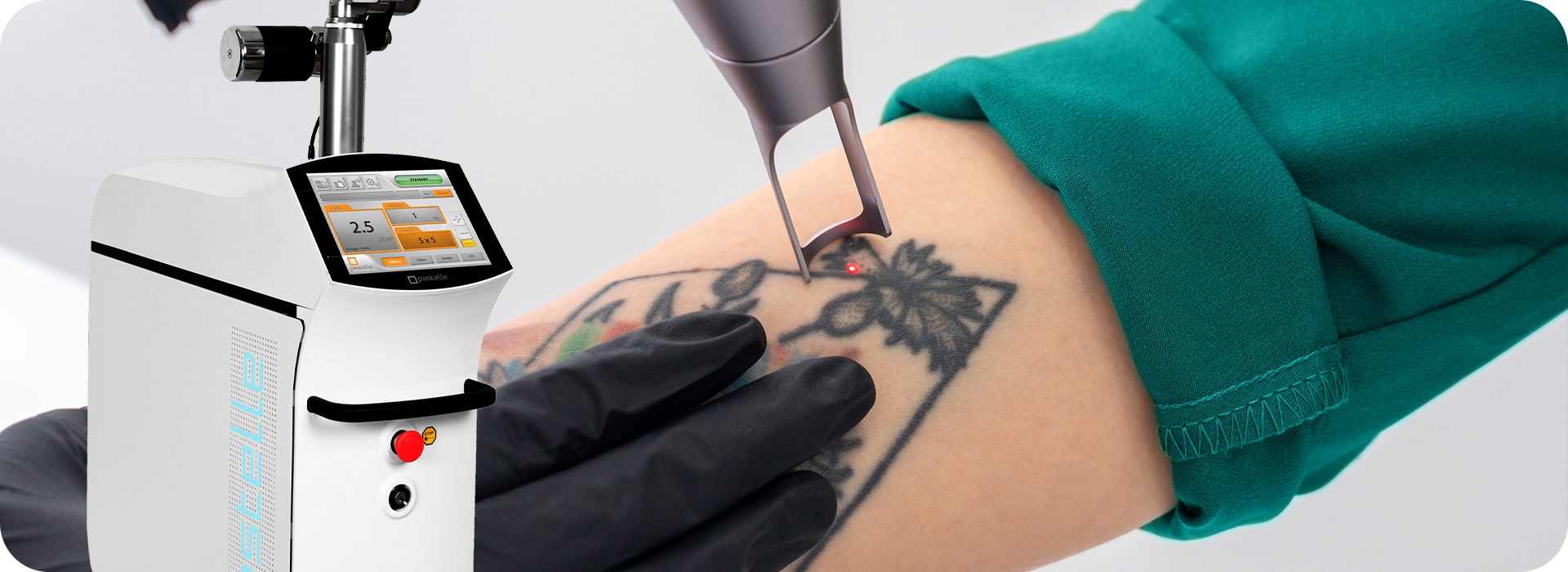 Profissional utilizando laser Pastelle na remoção de micropigmentação em procedimento estético seguro e eficaz.