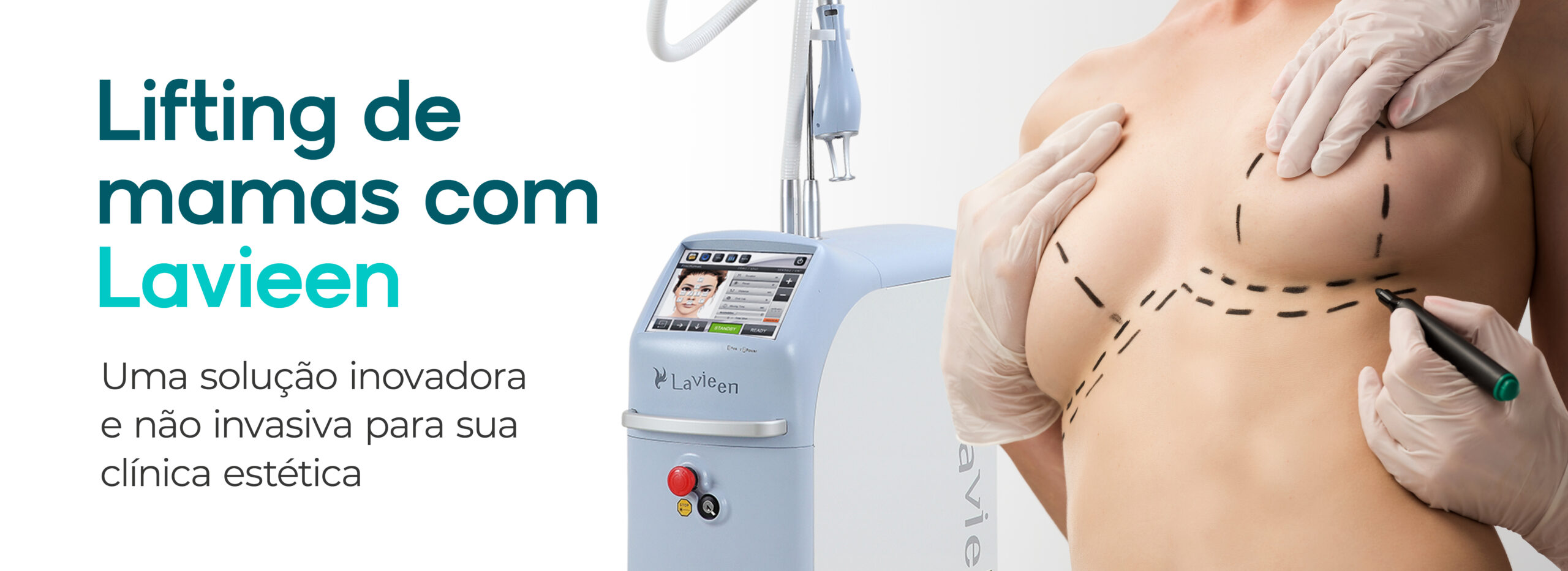 Mulher sendo preparada para lifting de mamas não invasivo com equipamento Lavieen, tecnologia de laser de Thulium.